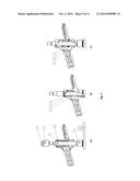 UNIT FOR FIXING AN AUTOMOTIVE WIPER DEVICE diagram and image