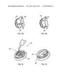 METHODS AND DEVICES FOR RETROFITTING FOOTWEAR TO INCLUDE A REEL BASED     CLOSURE SYSTEM diagram and image