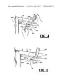 METHOD AND APPARATUS FOR INSTALLING ALARM SYSTEMS AND DOOR LOCKS diagram and image