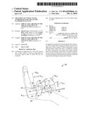 TREATMENT OF CARPAL TUNNEL SYNDROME BY INJECTION OF THE FLEXOR RETINACULUM diagram and image