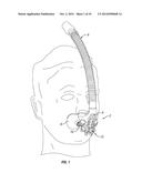 Adjustable Breathing Device diagram and image