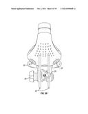 Adjustable Breathing Device diagram and image