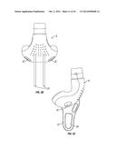 Adjustable Breathing Device diagram and image