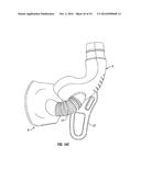 Adjustable Breathing Device diagram and image