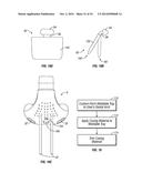 Adjustable Breathing Device diagram and image