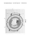 HIGH RESOLUTION SINGLE PHOTON EMISSION COMPUTED TOMOGRAPHY (SPECT) SYSTEM diagram and image