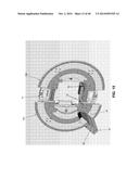 HIGH RESOLUTION SINGLE PHOTON EMISSION COMPUTED TOMOGRAPHY (SPECT) SYSTEM diagram and image