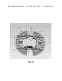 HIGH RESOLUTION SINGLE PHOTON EMISSION COMPUTED TOMOGRAPHY (SPECT) SYSTEM diagram and image