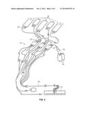 Citrate Detector For Blood Processing System diagram and image