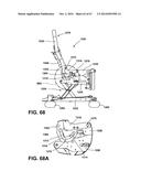 MEDICAL SUPPORT APPARATUS diagram and image