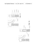 PRE-COMPRESSION DUAL SPRING PUMP CONTROL diagram and image