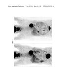 Anti-Pancreatic Cancer Antibodies diagram and image