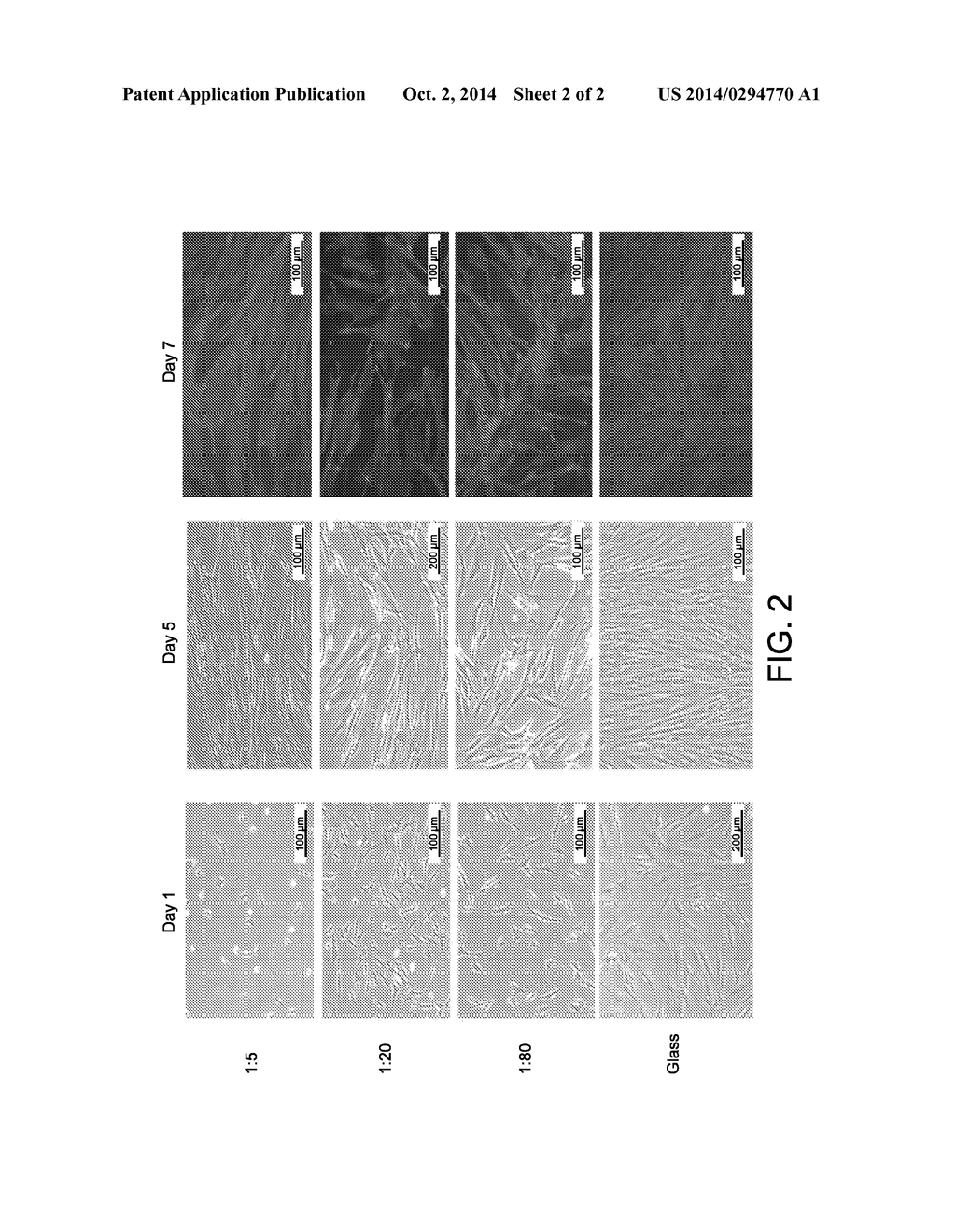 COMPOSITIONS AND METHODS FOR SPINAL DISC REPAIR AND OTHER SURGICAL AND     NON-SURGICAL INDICATIONS - diagram, schematic, and image 03