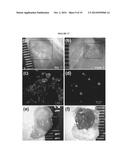 IMPLANTABLE MODULAR HYDROGEL FOR SALIVARY GLAND RESTORATION diagram and image