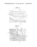CANCER CELL-INHIBITING CERAMIC, PROCESS FOR PRODUCING CANCER     CELL-INHIBITING CERAMIC, METHOD FOR TREATING BONE TUMOR, AND USE OF     BETA-TRICALCIUM PHOSPHATE POROUS GRANULES WITH PARTICLE SIZE OF 1 TO 10     MICROMETER diagram and image
