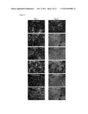 BONE PASTES COMPRISING BIOFUNCTIONALIZED CALCIUM PHOSPHATE CEMENTS WITH     ENHANCED CELL FUNCTIONS FOR BONE REPAIR diagram and image