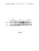 BISPHOSPHONATE COMPOSITIONS AND METHODS FOR TREATING AND\OR REDUCING     CARDIAC DYSFUNCTION diagram and image