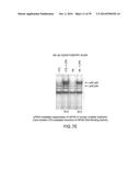 Use Of siRNA To Achieve Down Regulation Of An Endogenous Gene In     Combination With The Use of A Sense Construct To Achieve Expression Of A     Polynucleotide diagram and image