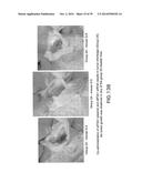 Use Of siRNA To Achieve Down Regulation Of An Endogenous Gene In     Combination With The Use of A Sense Construct To Achieve Expression Of A     Polynucleotide diagram and image