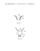 VENTRICULAR VOLUME REDUCTION diagram and image