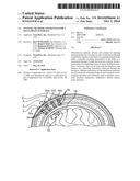 SYSTEMS, METHODS AND DEVICES FOR A SKULL/BRAIN INTERFACE diagram and image