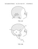 SYSTEMS, METHODS AND DEVICES FOR A SKULL/BRAIN INTERFACE diagram and image