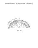 SYSTEMS, METHODS AND DEVICES FOR A SKULL/BRAIN INTERFACE diagram and image