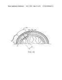 SYSTEMS, METHODS AND DEVICES FOR A SKULL/BRAIN INTERFACE diagram and image