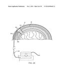 SYSTEMS, METHODS AND DEVICES FOR A SKULL/BRAIN INTERFACE diagram and image