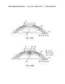 SYSTEMS, METHODS AND DEVICES FOR A SKULL/BRAIN INTERFACE diagram and image