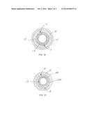 Pacemaker Lead and Other Medical Implant Devices diagram and image