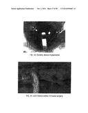 PRESSURE SENSORS FOR SMALL-SCALE APPLICATIONS AND RELATED METHODS diagram and image