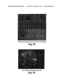 PRESSURE SENSORS FOR SMALL-SCALE APPLICATIONS AND RELATED METHODS diagram and image