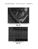 PRESSURE SENSORS FOR SMALL-SCALE APPLICATIONS AND RELATED METHODS diagram and image