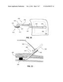 AUTOMATIC DEVICES FOR REMOTE ISCHEMIC PRECONDITIONING diagram and image