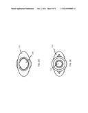 Ophthalmic Implant for Delivering Therapeutic Substances diagram and image