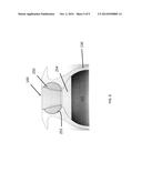 Ophthalmic Implant for Delivering Therapeutic Substances diagram and image