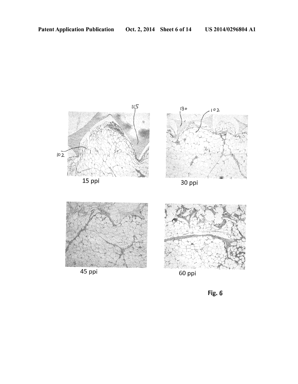 WOUND CONTACTING MEMBERS AND METHODS - diagram, schematic, and image 07