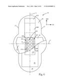 ZONED TOPSHEET diagram and image