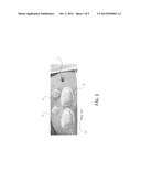 Dual-use Catheter for Continuous Analyte Measurement and Drug Delivery diagram and image