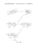 Medicine Delivery Device Having Detachable Pressure Sensing Unit diagram and image