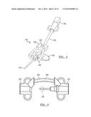 INTEGRATED VASCULAR DELIVERY SYSTEM diagram and image