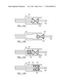 INTEGRATED VASCULAR DELIVERY SYSTEM diagram and image