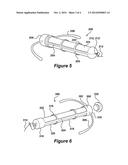 INTRAUTERINE SYSTEM FOR USE IN MEDICAL TREATMENT diagram and image