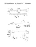 Spinal Instrument For Measuring Load and Position Of Load diagram and image