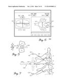 Spinal Instrument For Measuring Load and Position Of Load diagram and image