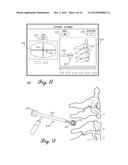 Spinal Instrument For Measuring Load and Position Of Load diagram and image