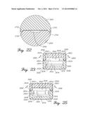 Spinal Instrument For Measuring Load and Position Of Load diagram and image