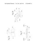 DEVICE FOR REMOVING ACROCHORDONS diagram and image