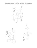 DEVICE FOR REMOVING ACROCHORDONS diagram and image